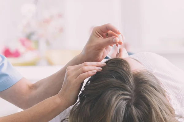 Terapeuten använder akupunktur nål — Stockfoto