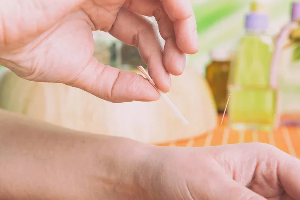 Self Applying Acupuncture Needle Hand — Stock Photo, Image