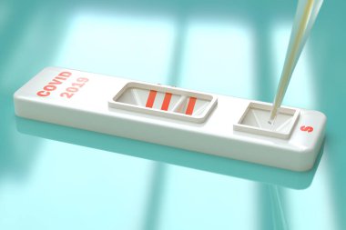 COVID19 SARS virüsü hızlı bir test. Rapid Covid 19 testi. Pipette numune koyuyor. 3 boyutlu illüstrasyon. Testler IgM ve IgG dahil antikorların üretilmesinde etkilidir.