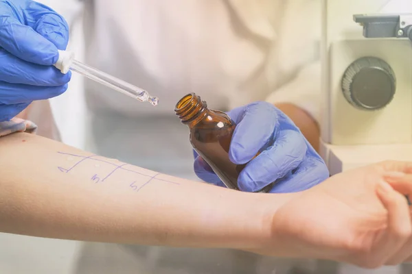 Ιατρός Που Κάνει Δοκιμές Αλλεργίας Στο Εργαστήριο — Φωτογραφία Αρχείου