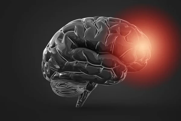 Brain Inflammation Other Process Associated Tissues Damage Thinking Conceptual Illustration — Stock Photo, Image