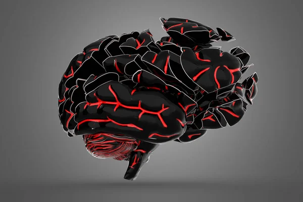 破碎的大脑 概念三维图解在脑疾病可视化中的应用 — 图库照片