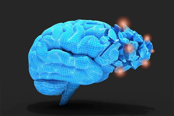 Brain Inflammation Other Process Associated Tissues Damage Thinking Conceptual Illustration — Stock Photo, Image