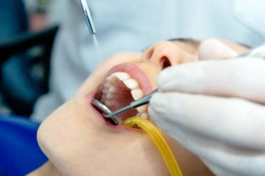 Diş klinik bir dişçi ile yıkama