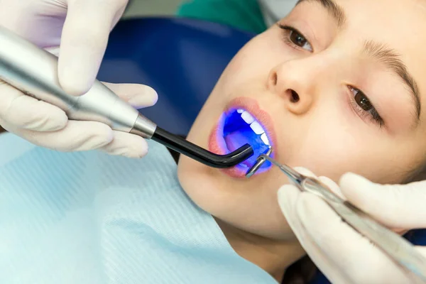 ตรวจฟันที่โคมไฟอัลตราไวโอเลตของหมอฟัน — ภาพถ่ายสต็อก