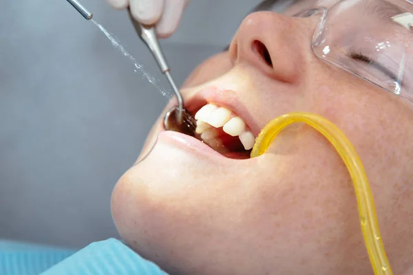 O médico escova os dentes de leite — Fotografia de Stock