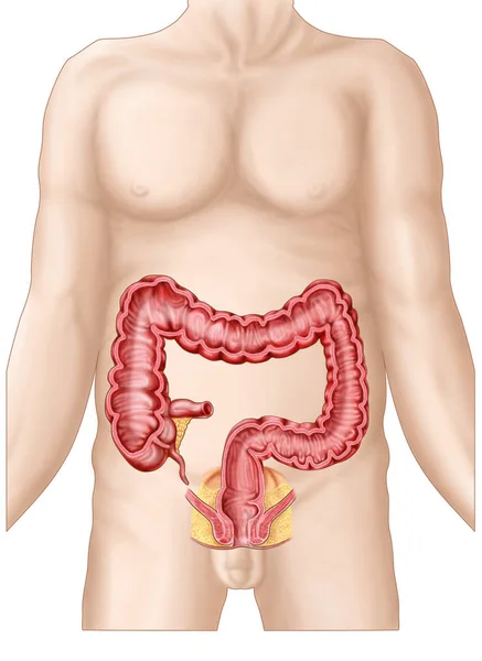 大腸は小腸の断面図 — ストック写真