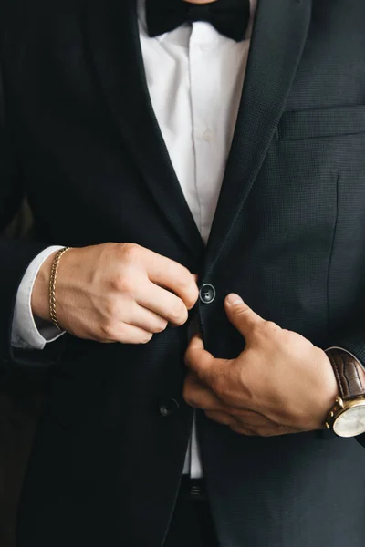 Os detalhes do dia do casamento. Preparação do noivo . — Fotografia de Stock