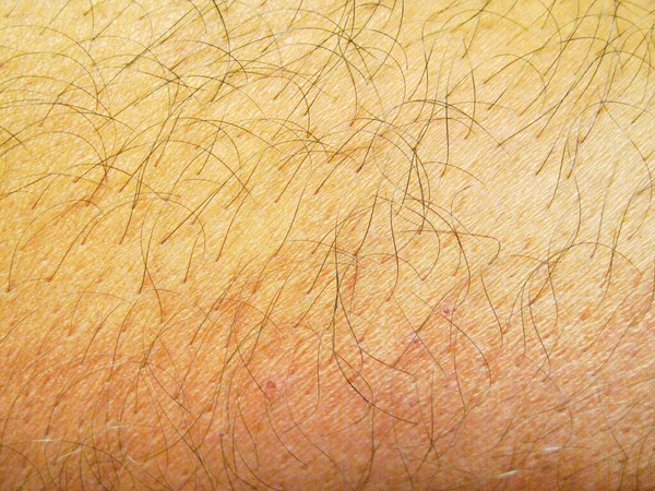 Brown Hairy Human Skin Texture — Stock Photo, Image