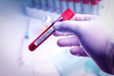 Tıbbi eldiven giyen doktor, Coronavirus 2019-ncov kan örneği içeren bir kan tüpü tutuyor..