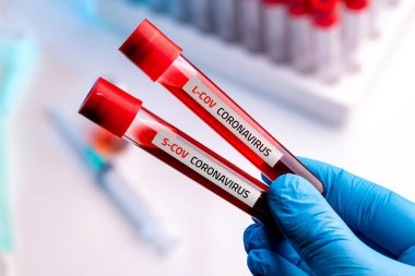 Tıbbi eldiven giyen doktor Coronavirus 2019-nCoV S-cov ve L-Cov kan örneği içeren bir kan tüpü tutuyor..