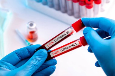 Tıbbi eldiven giyen doktor Coronavirus 2019-nCoV S-cov ve L-Cov kan örneği içeren bir kan tüpü tutuyor..