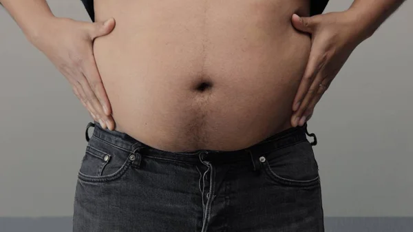 Sobrepeso homem closeup de barriga — Fotografia de Stock