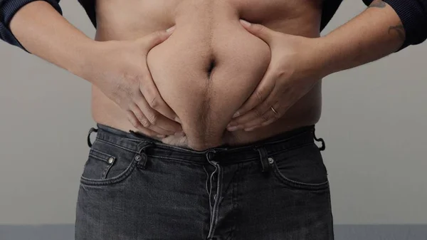 Sobrepeso homem closeup de barriga — Fotografia de Stock
