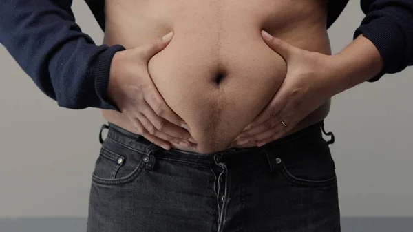 Overweight man closeup of belly — Stock Photo, Image