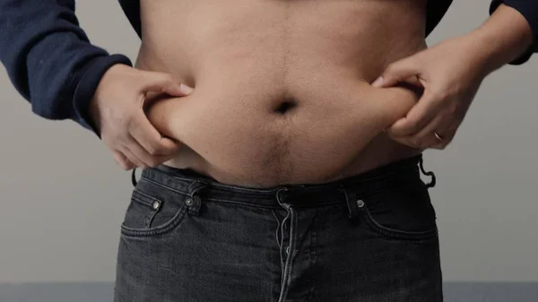 Sobrepeso hombre primer plano de vientre — Foto de Stock
