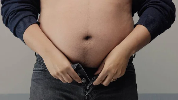 Sobrepeso homem closeup de barriga — Fotografia de Stock