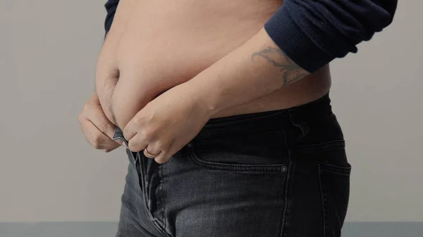 Zbliżenie nadwagą mężczyzna brzuchem — Zdjęcie stockowe