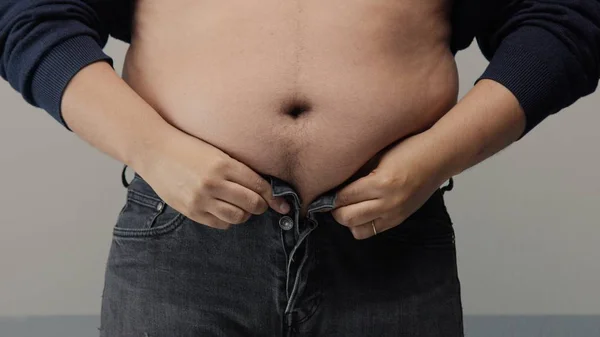 Sobrepeso homem closeup de barriga — Fotografia de Stock