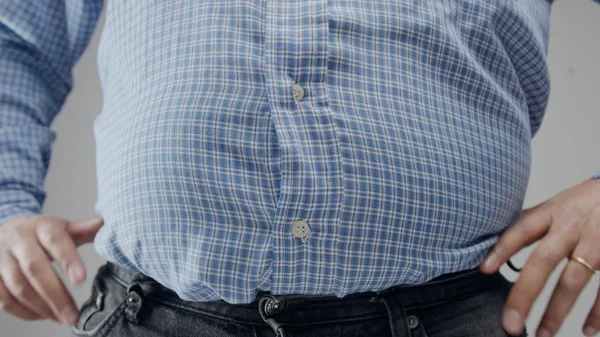 Overweight man closeup of belly Diet concept. Fisheye belly closeup — Stock Photo, Image