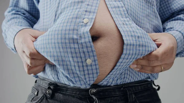 Overweight man closeup of belly Diet concept. Fisheye belly closeup — Stock Photo, Image