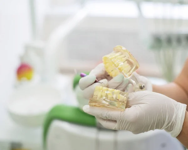 Tandläkaren håller en mock tänder och förklarar för patienten loppet av behandlingen. Närbild av en läkare händer i handskar med ett verktyg och konstgjord käke. — Stockfoto