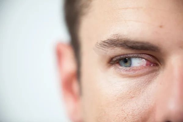 Человек с контактными линзами — стоковое фото