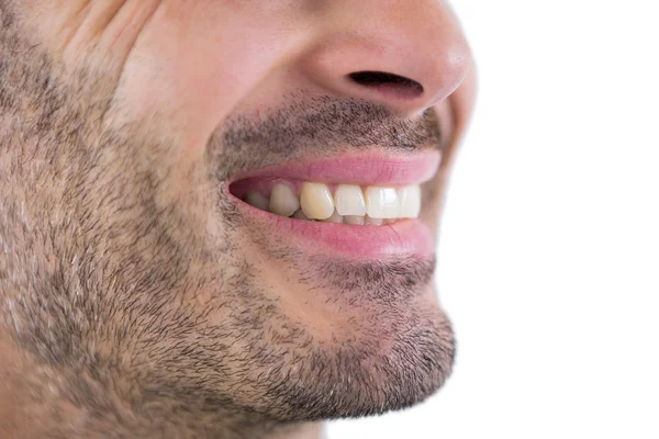 Man showing his teeth — Stock Photo, Image