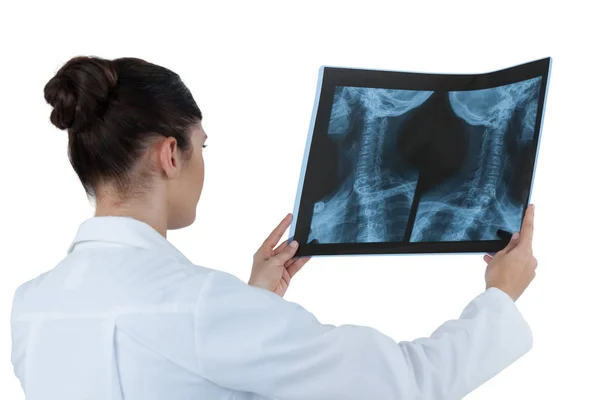 Vrouwelijke arts controleren x-ray verslag — Stockfoto