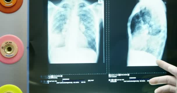 Врач осматривает рентген — стоковое видео