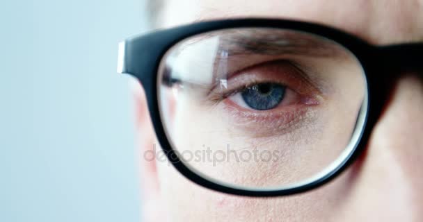 Close-up do olho do doente — Vídeo de Stock