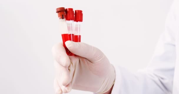 Lab technician holding blood samples — Stock Video