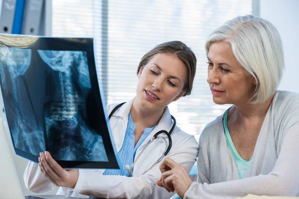 Médecin féminin expliquant le rapport de radiographie au patient — Photo