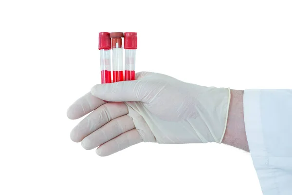 Doctor hand holding test tubes — Stock Photo, Image