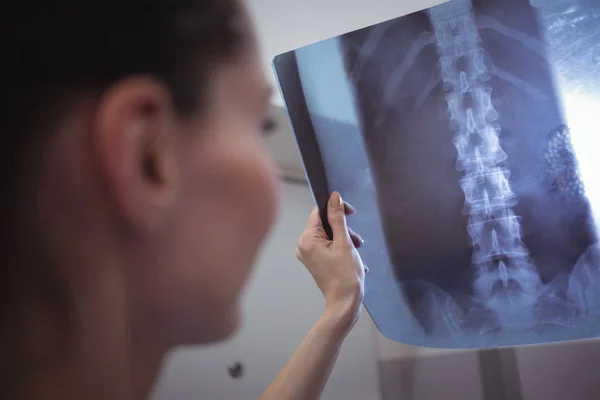 X-ışını raporu inceleyerek kadın hemşire — Stok fotoğraf