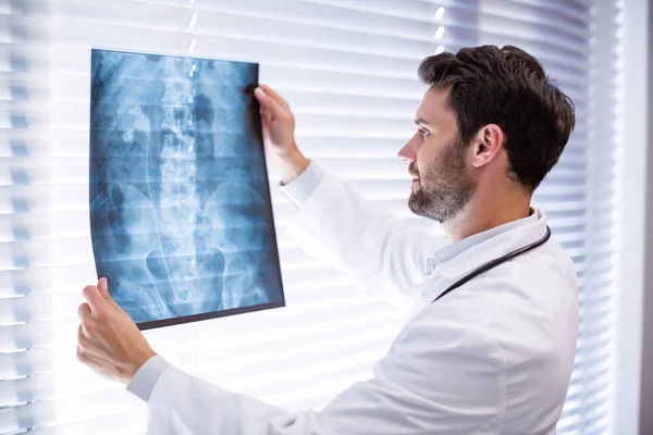 Médico masculino examinando raio-X — Fotografia de Stock