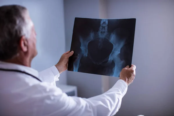 Доктор-мужчина, изучающий рентгеновский отчет — стоковое фото