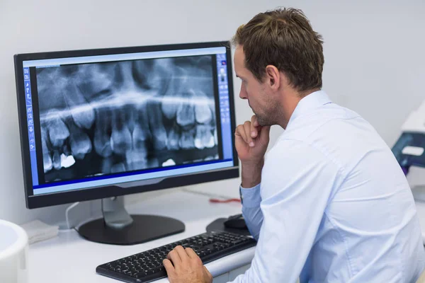 Zahnarzt untersucht Röntgenbild am Computer — Stockfoto