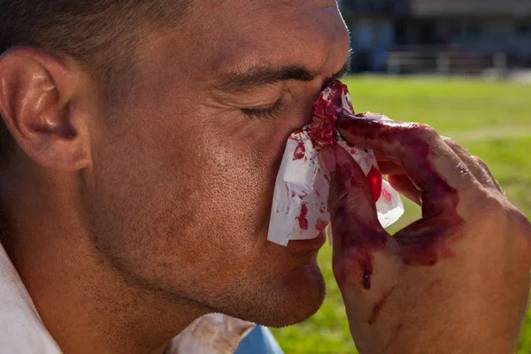 Jogador de rugby com nariz ferido — Fotografia de Stock