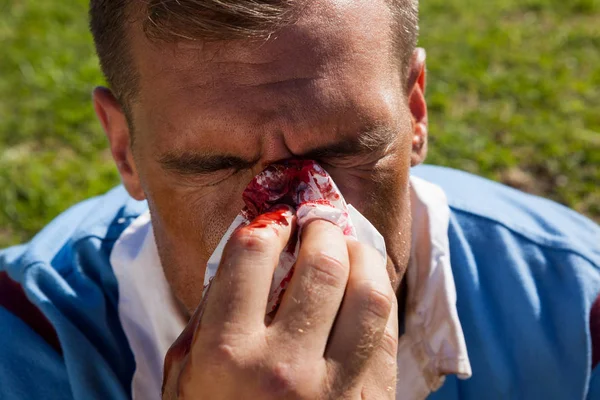 Jogador de rugby com nariz ferido — Fotografia de Stock
