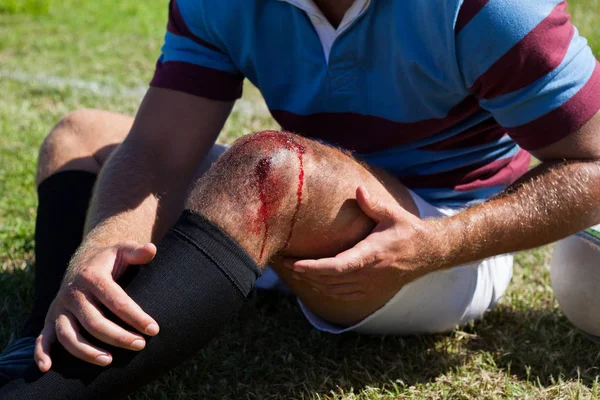 Gracz rugby z poszkodowanej kolana — Zdjęcie stockowe