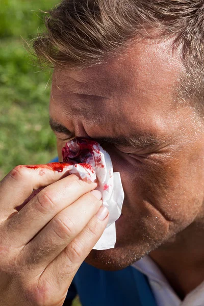 Jogador de rugby cobrindo nariz ferido — Fotografia de Stock