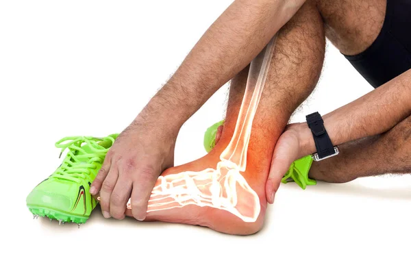Huesos de la pierna resaltados del hombre herido —  Fotos de Stock