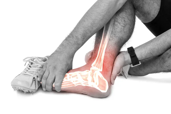 Huesos de la pierna resaltados del hombre herido — Foto de Stock
