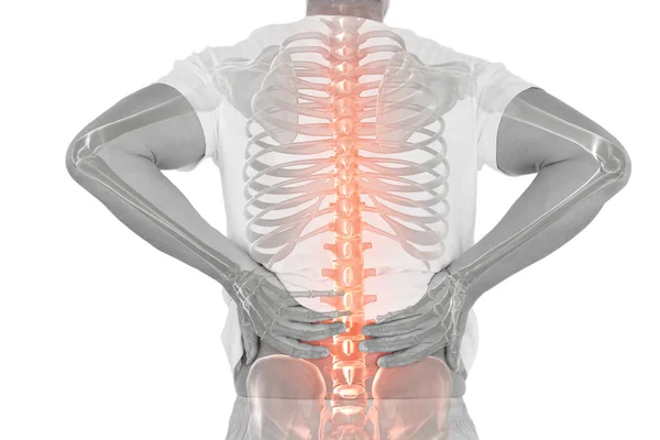 Männliche Wirbelsäule mit Rückenschmerzen — Stockfoto