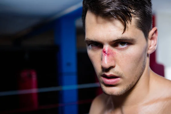 流血的鼻子的男性拳击手 — 图库照片