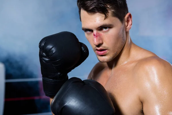 Boxeur masculin avec saignement du nez — Photo