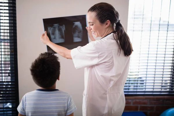 Orvos találat röntgen, a boy — Stock Fotó