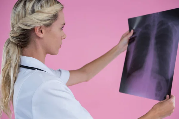 Ženský doktor dívající se na rentgen — Stock fotografie