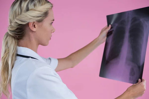 Médecin féminin qui regarde la radiographie — Photo